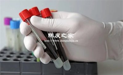 陈皮黄酮类成分抗动脉硬化的作用